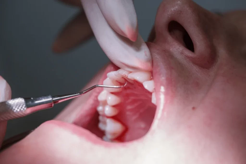 Dental Hygienists (1)