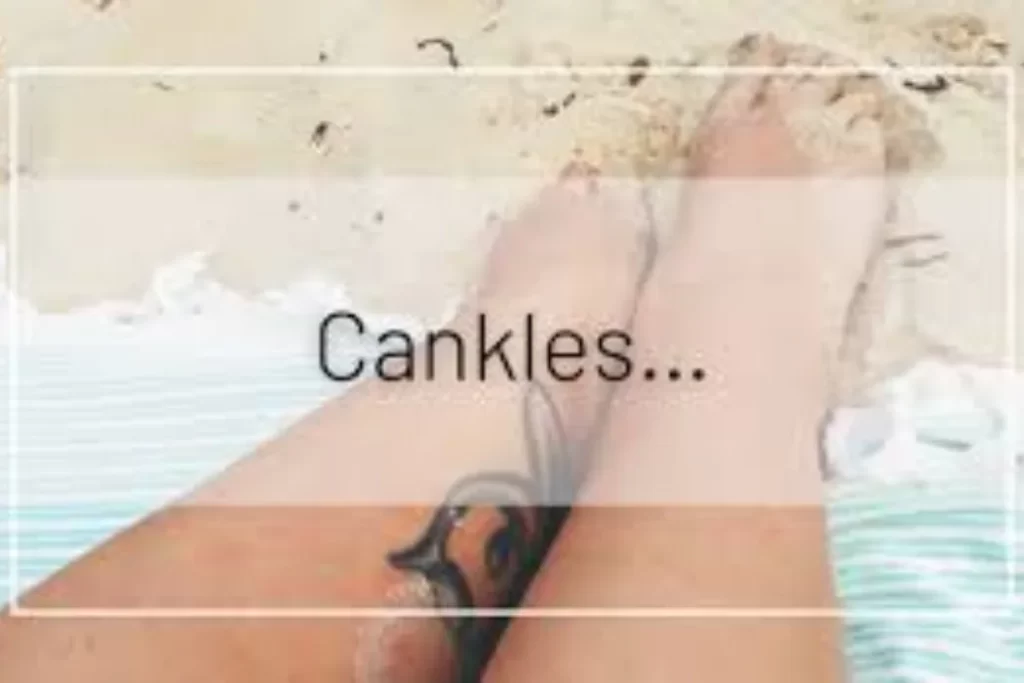 cankles