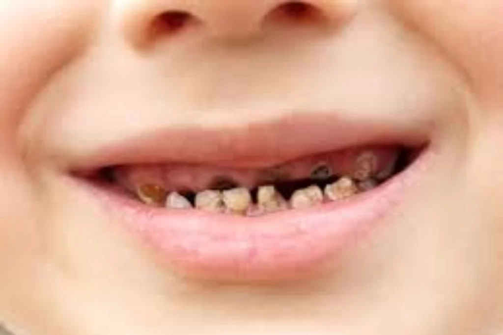 black teeth