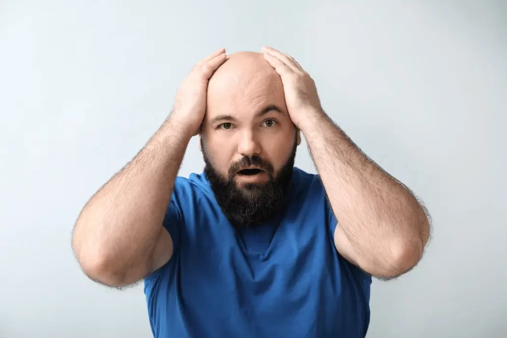 baldness cure