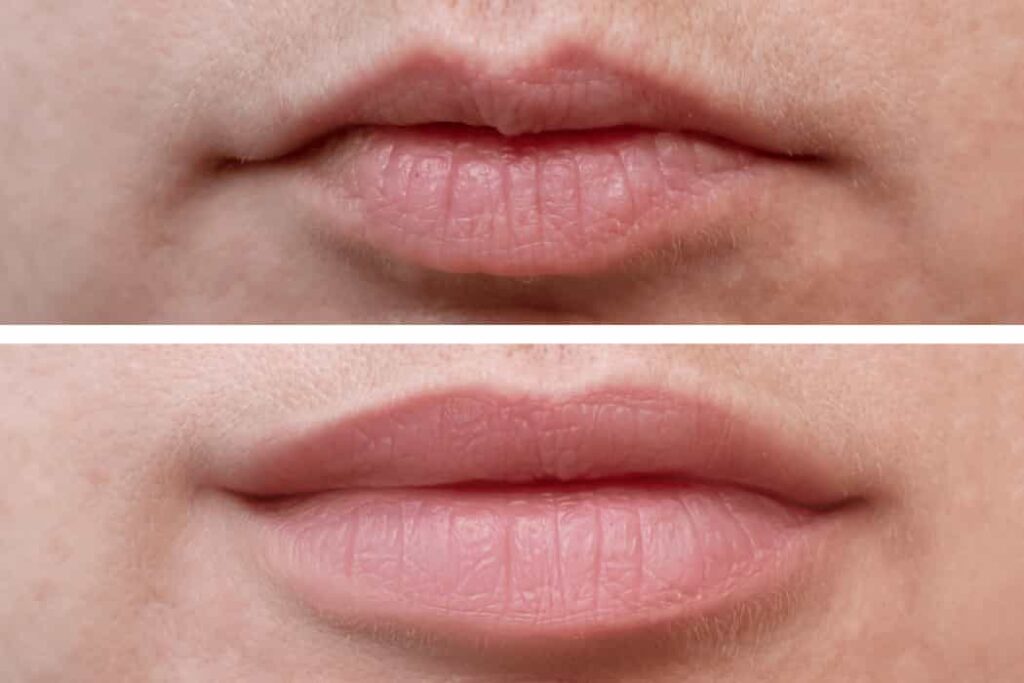 lip shapes