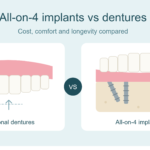 all_on_4_vs_dentures_featured_image