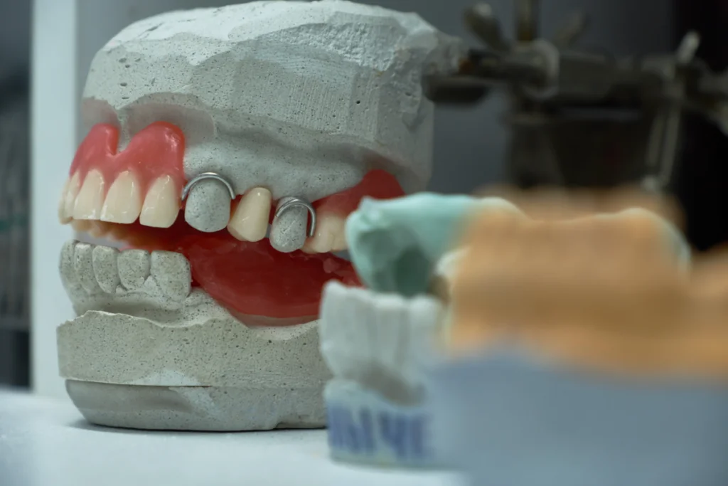 Implant dentistry