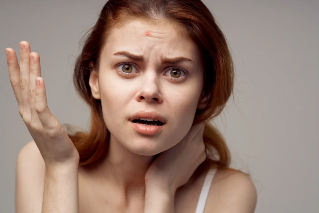 How to Get Rid of Blackheads and Pimples Overnight Get Rid of Blackheads