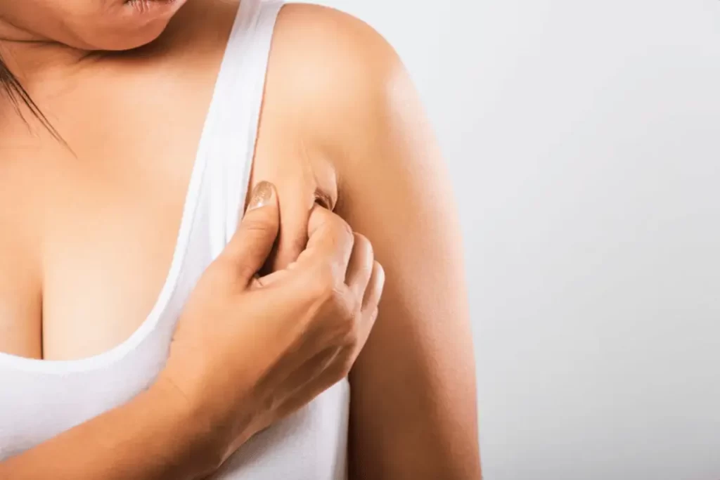 Dealing with Armpit Fat: Causes, Prevention, and Solutions Armpit Fat 1