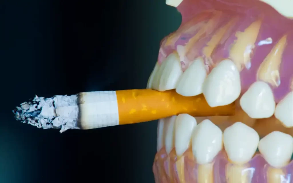 Teeth Whitening for Smokers