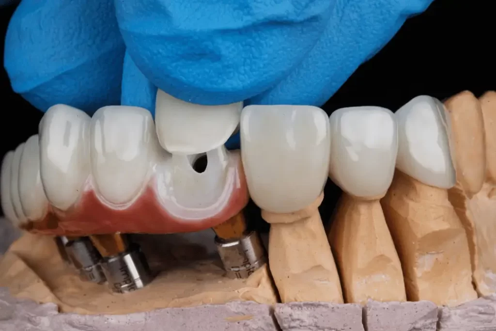 Cosmetic Dentistry