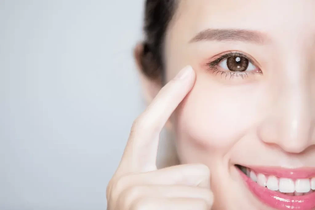 canthoplasty 1