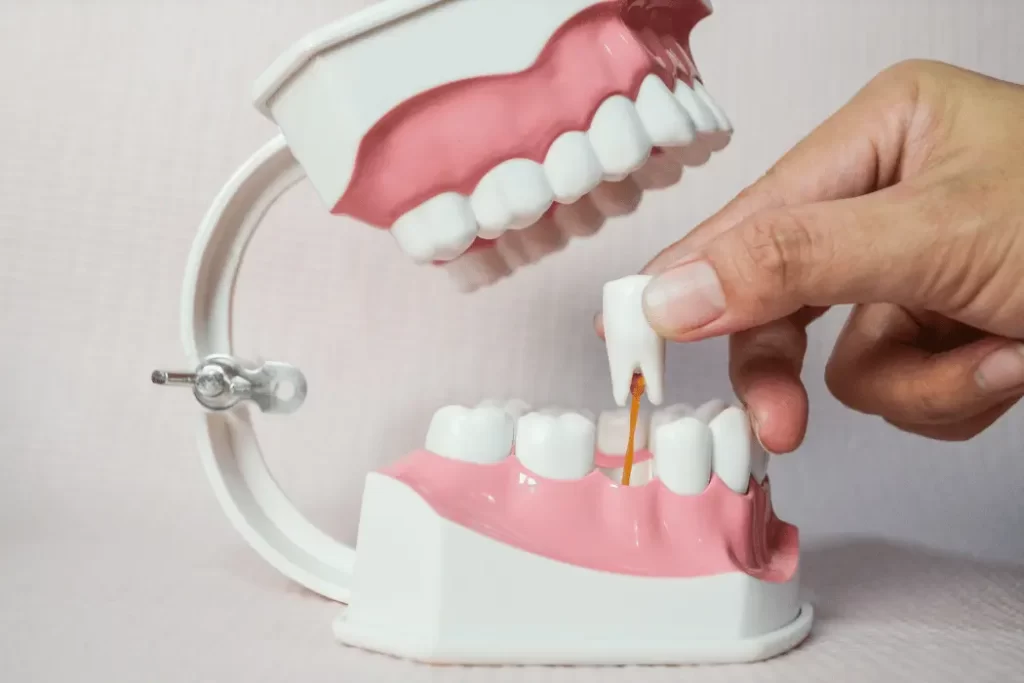 dead tooth