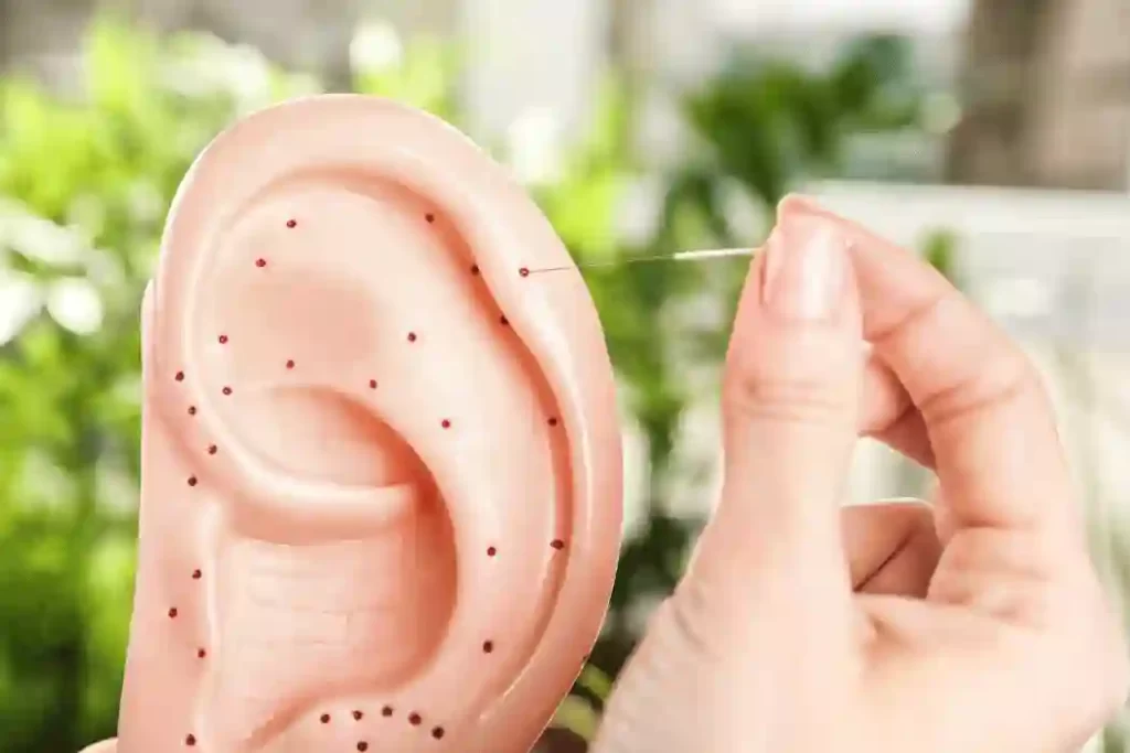 Ear Acupuncture