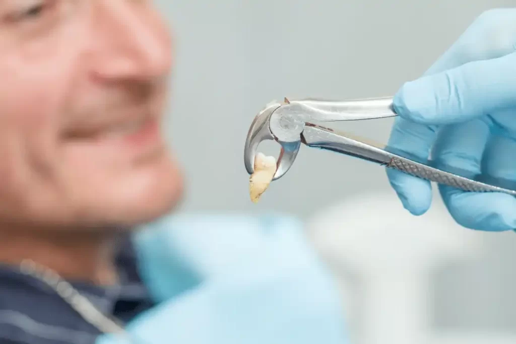 Tooth Extraction 1