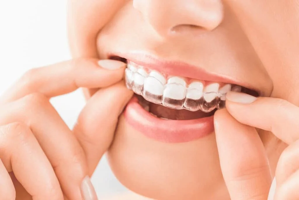 Orthodontic (1)