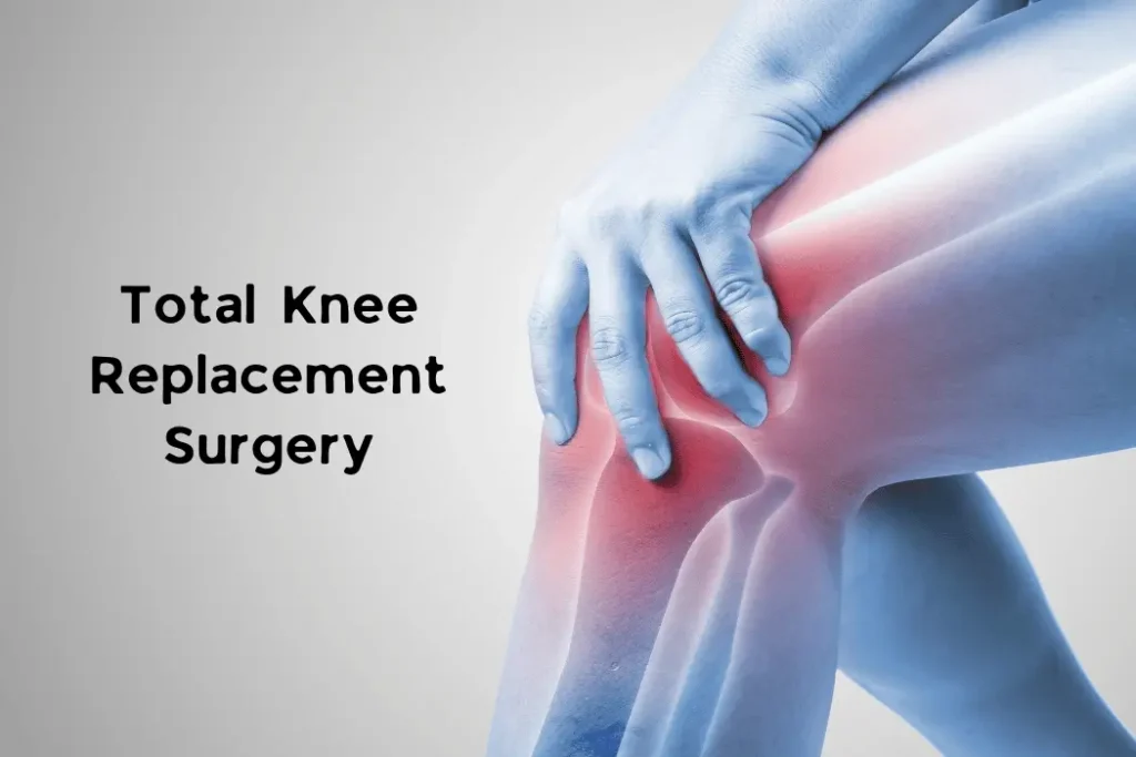 Knee Replacement Surgery (1)