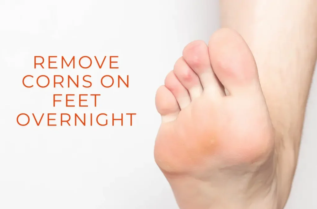remove corns on feet overnight (2)